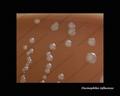 haemophilus influenzae